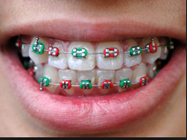 orthodontic treatment - braces
