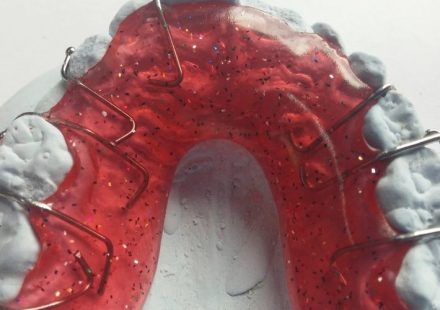Orthodontic Treatment – Your Questions Answered