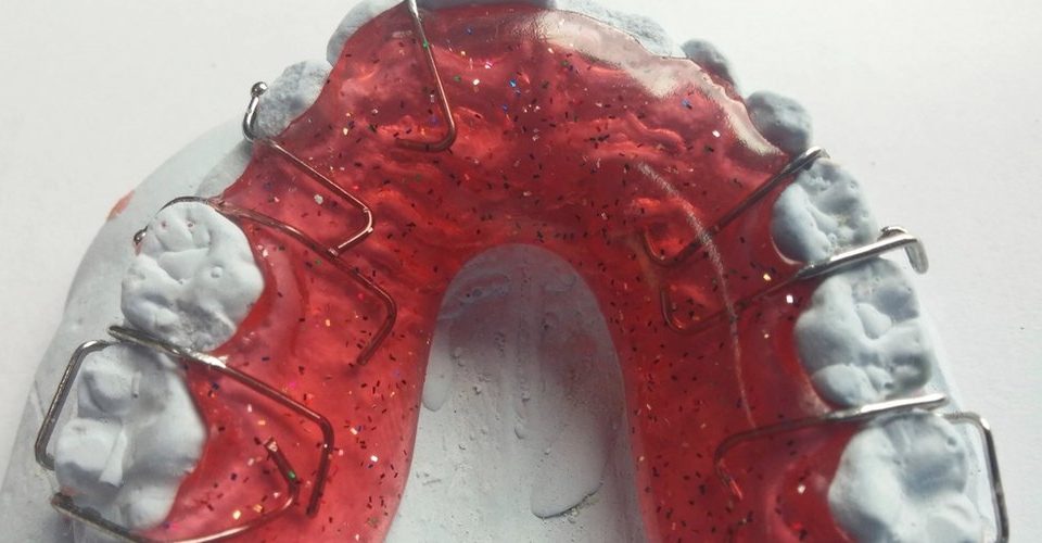 Orthodontic Treatment – Your Questions Answered